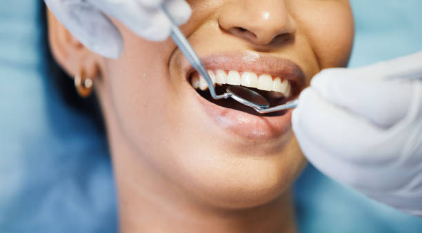 Best Emergency Denture Repair in York, SC